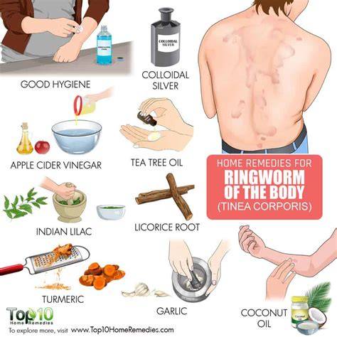 What Kills Ringworm On Skin