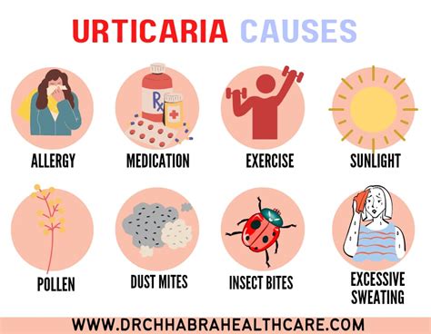 What Triggers Urticaria