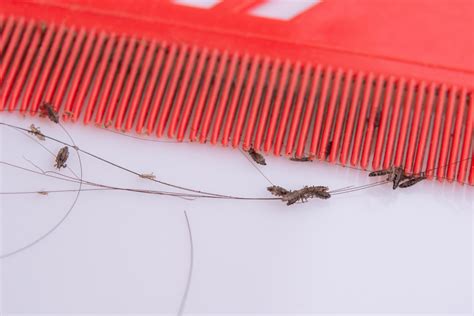 Where Do Lice Come From Head Lice