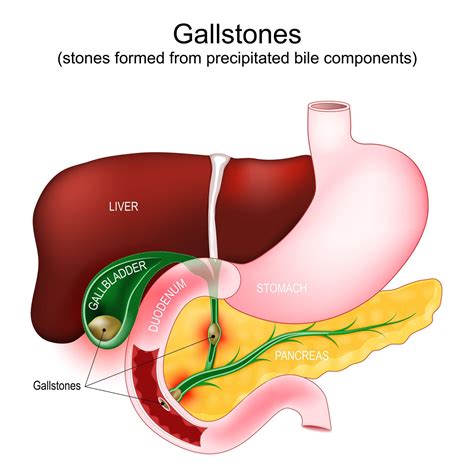Where Is A Gallbladder
