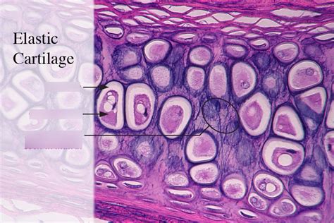 Where Is Elastic Cartilage Found