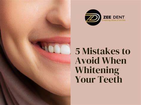 Top Whitening Teeth Mistakes to Avoid for a Brighter Smile
