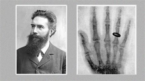Who Discovered X Ray