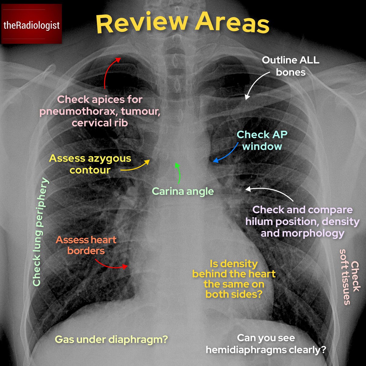 Xray Tech Jobs