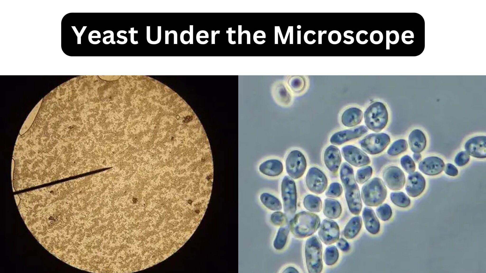 Yeast Infection Belly Button
